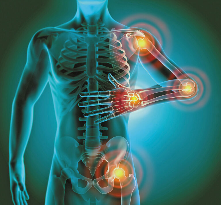 Pain & Inflammation…Is It Your Friend?